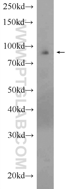 Western Blot (WB) analysis of rat skeletal muscle tissue using PARP9 Polyclonal antibody (17535-1-AP)