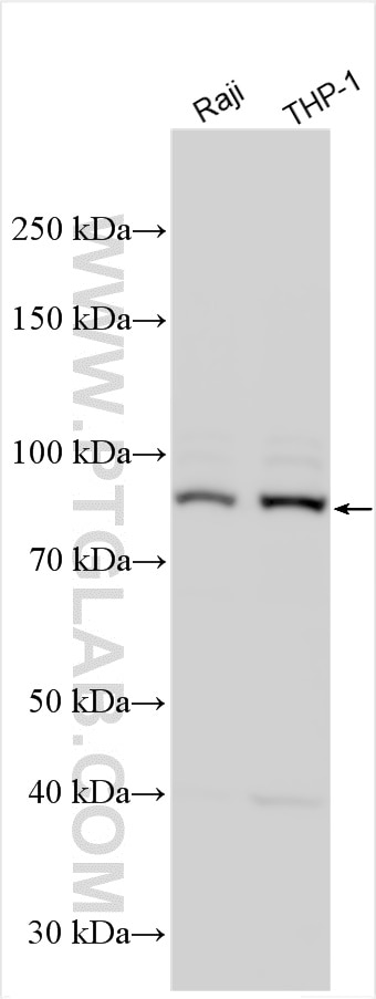 Western Blot (WB) analysis of various lysates using PARP9 Polyclonal antibody (17535-1-AP)