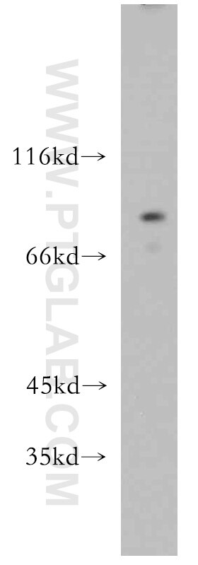 Western Blot (WB) analysis of HeLa cells using PARP9 Polyclonal antibody (17535-1-AP)