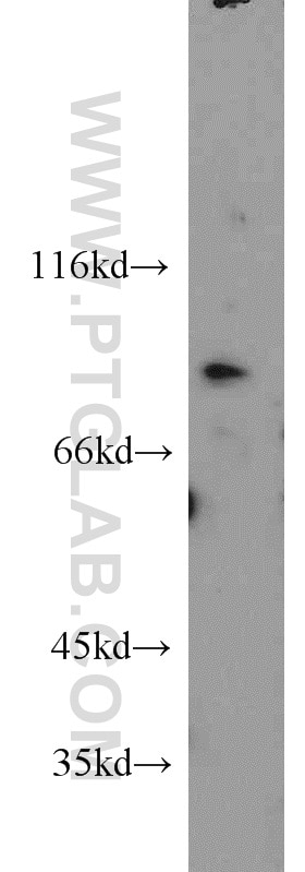 Western Blot (WB) analysis of MCF-7 cells using PARP9 Polyclonal antibody (17535-1-AP)