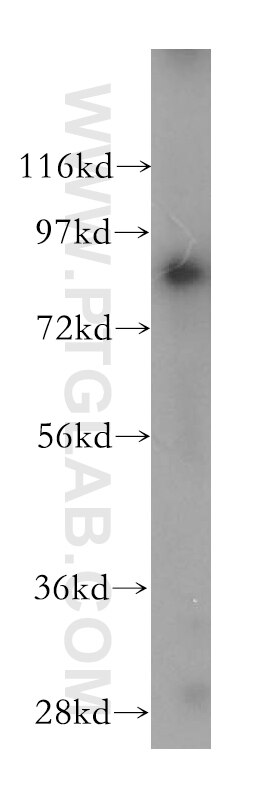Western Blot (WB) analysis of K-562 cells using PARP9 Polyclonal antibody (17535-1-AP)