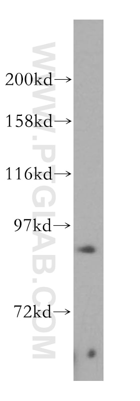 Western Blot (WB) analysis of HeLa cells using PARP9 Polyclonal antibody (17535-1-AP)