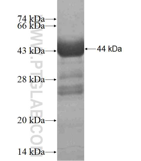 PARP9 fusion protein Ag11673 SDS-PAGE