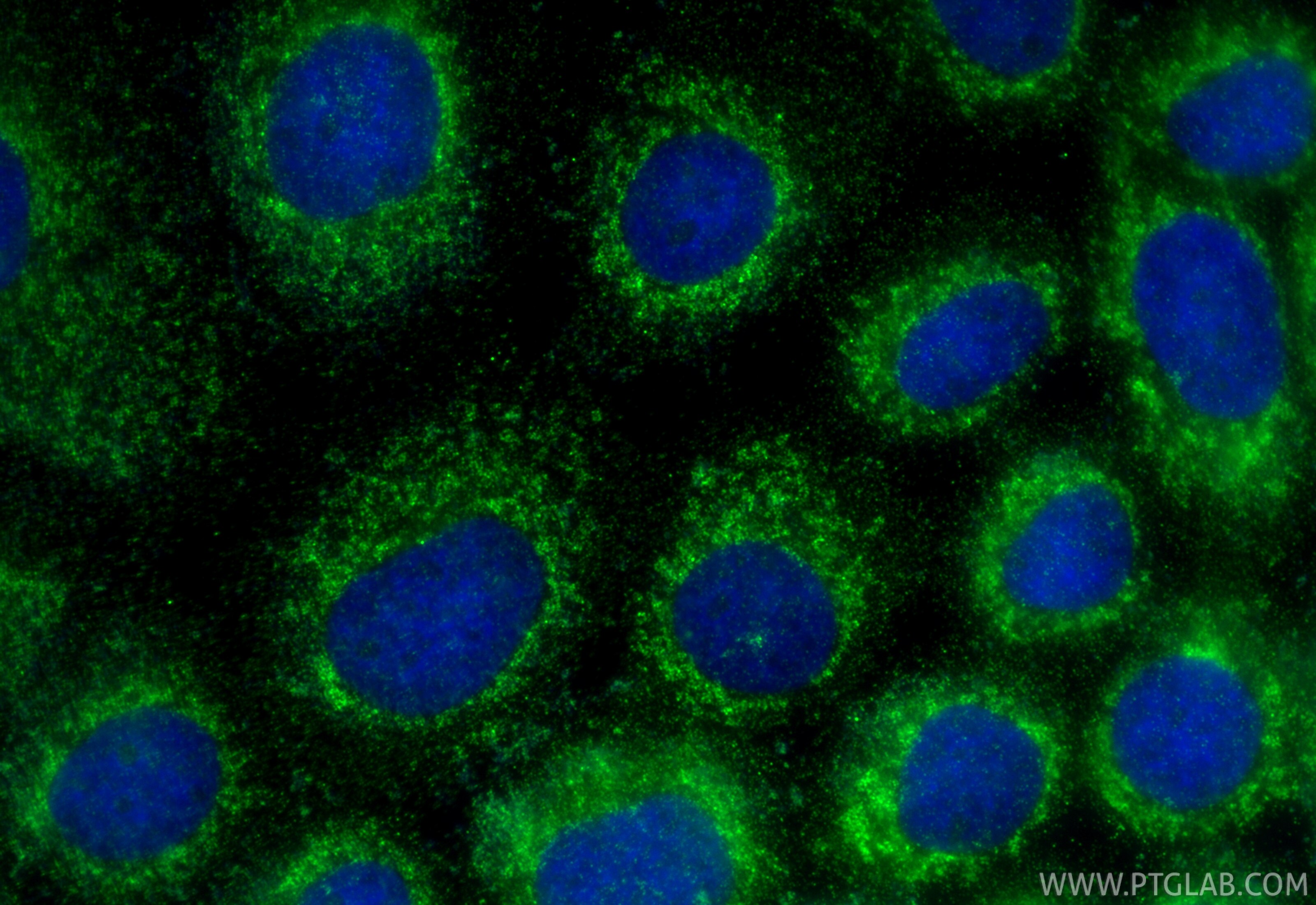 IF Staining of A431 using 15864-1-AP Immunofluorescence (IF) / fluorescent staining of A431 cells using PARS2 Polyclonal antibody (15864-1-AP)