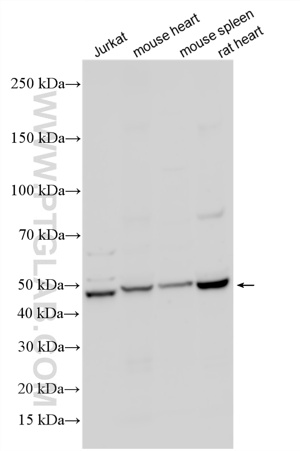 WB analysis using 15864-1-AP Western Blot (WB) analysis of various lysates using PARS2 Polyclonal antibody (15864-1-AP)