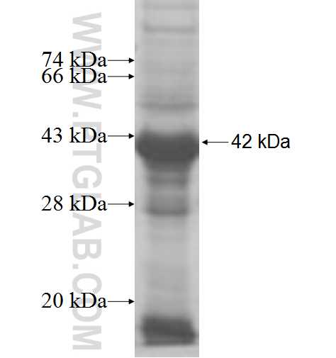 PARS2 fusion protein Ag8413 SDS-PAGE