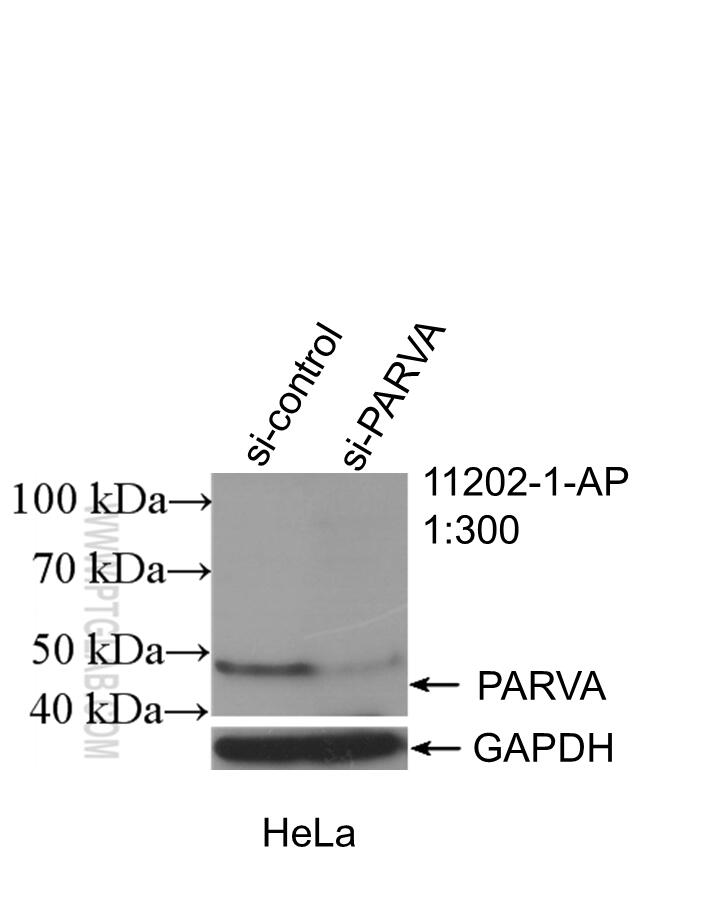 Western Blot (WB) analysis of HeLa cells using Alpha Parvin/Actopaxin Polyclonal antibody (11202-1-AP)