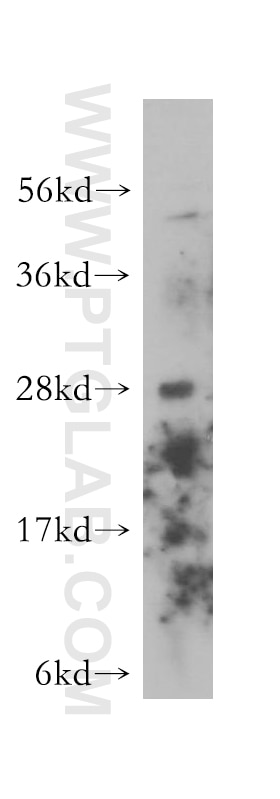 Alpha Parvin/Actopaxin