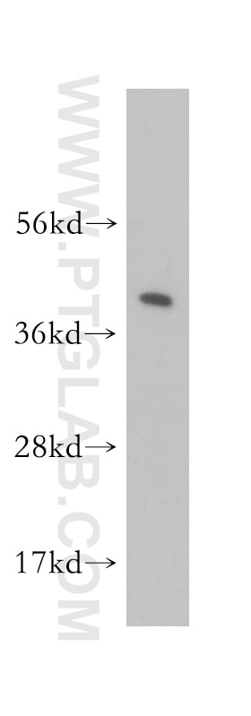 Western Blot (WB) analysis of human kidney tissue using Alpha Parvin/Actopaxin Polyclonal antibody (11202-1-AP)