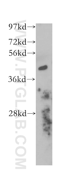 Western Blot (WB) analysis of Jurkat cells using Alpha Parvin/Actopaxin Polyclonal antibody (11202-1-AP)