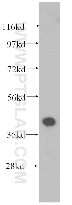 Western Blot (WB) analysis of human liver tissue using Alpha Parvin/Actopaxin Polyclonal antibody (11202-1-AP)