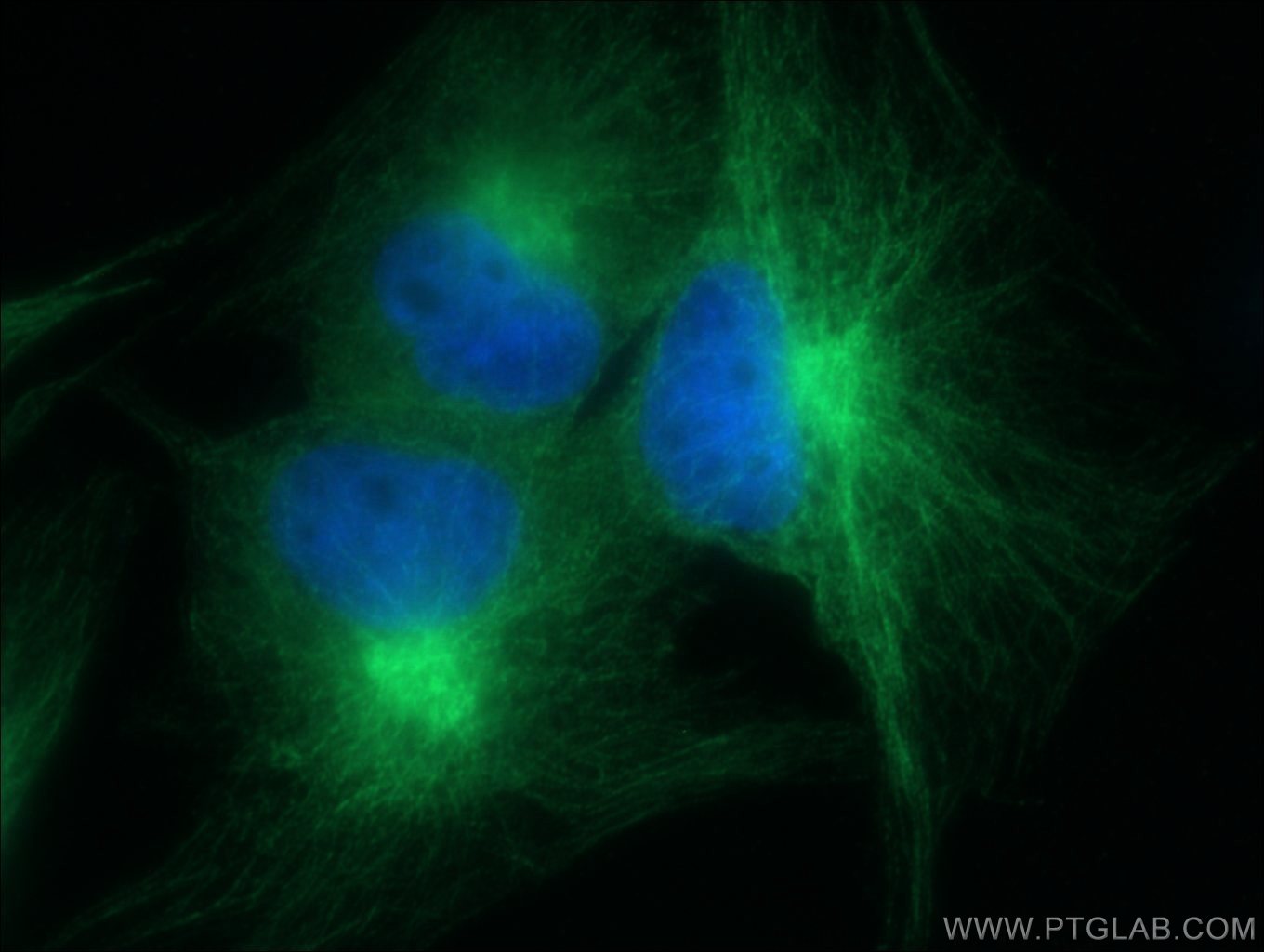 Immunofluorescence (IF) / fluorescent staining of MDCK cells using Alpha Parvin/Actopaxin Polyclonal antibody (55268-1-AP)