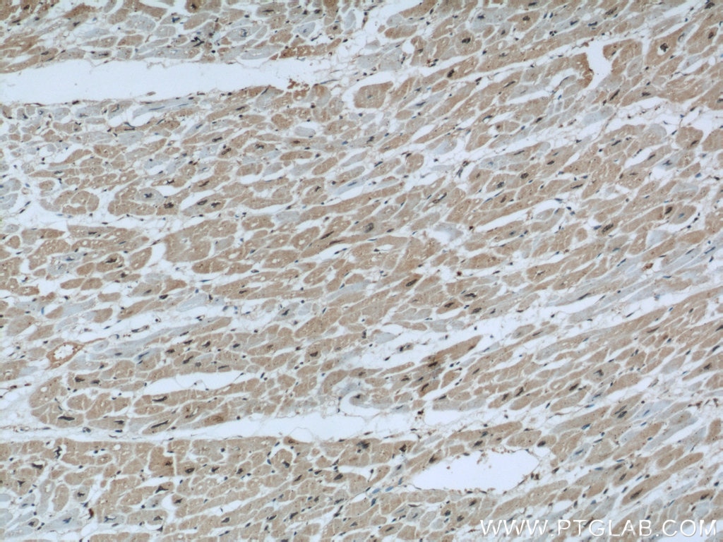 IHC staining of human heart using 55268-1-AP
