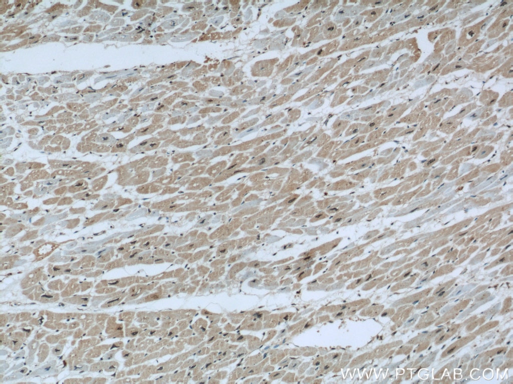 Immunohistochemistry (IHC) staining of human heart tissue using Alpha Parvin/Actopaxin Polyclonal antibody (55268-1-AP)