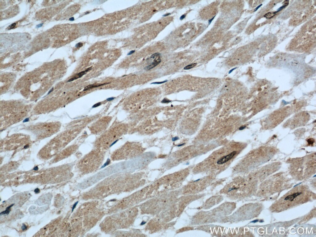 IHC staining of human heart using 55268-1-AP