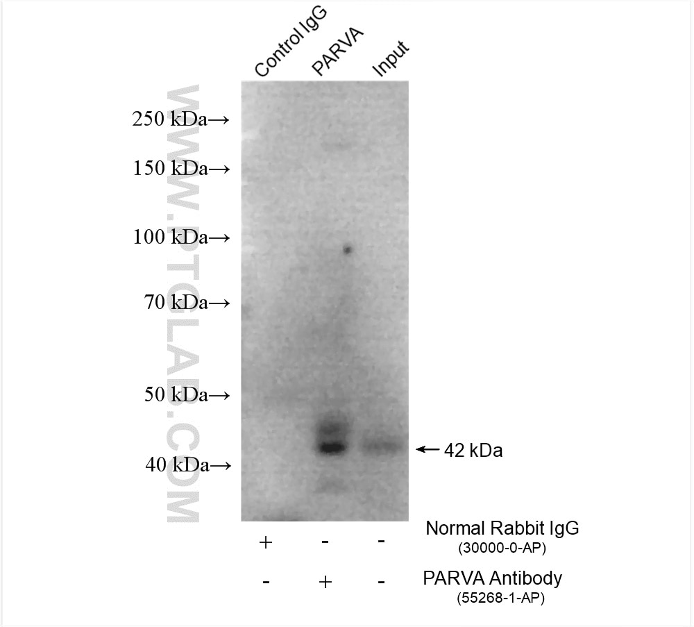 Immunoprecipitation (IP) experiment of U2OS cells using Alpha Parvin/Actopaxin Polyclonal antibody (55268-1-AP)