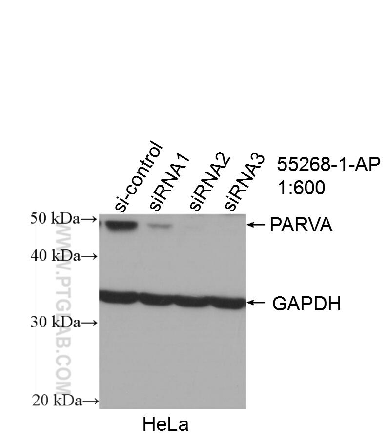Western Blot (WB) analysis of HeLa cells using Alpha Parvin/Actopaxin Polyclonal antibody (55268-1-AP)