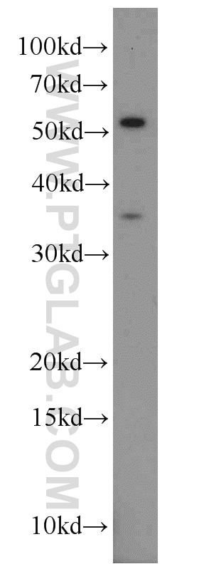 Western Blot (WB) analysis of mouse kidney tissue using Alpha Parvin/Actopaxin Polyclonal antibody (55268-1-AP)