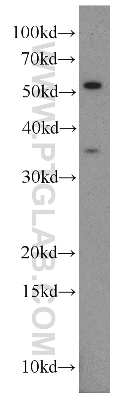 WB analysis of mouse kidney using 55268-1-AP