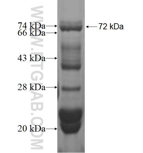 PARVA fusion protein Ag1694 SDS-PAGE