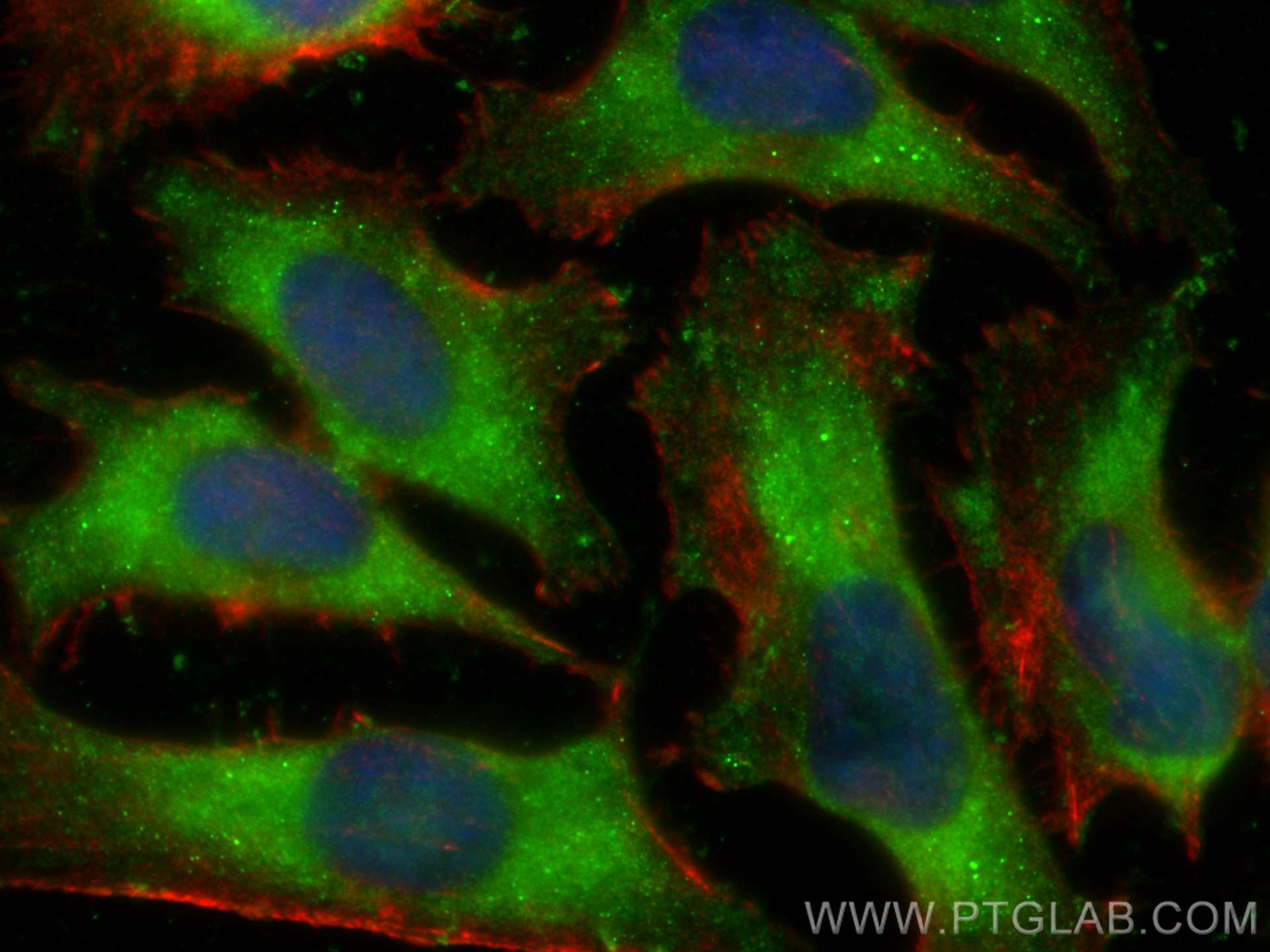 Immunofluorescence (IF) / fluorescent staining of HeLa cells using PARVB Polyclonal antibody (14463-1-AP)