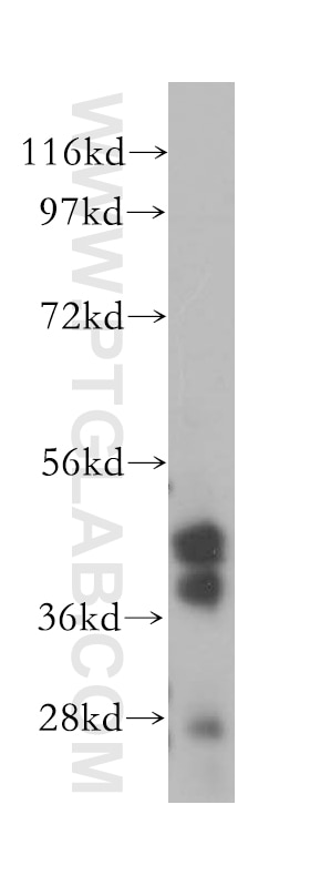 Western Blot (WB) analysis of mouse spleen tissue using PARVB Polyclonal antibody (14463-1-AP)