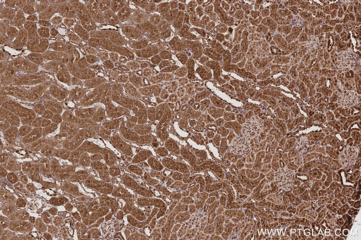 Immunohistochemistry (IHC) staining of rat kidney tissue using PARVB Recombinant monoclonal antibody (85711-1-RR)
