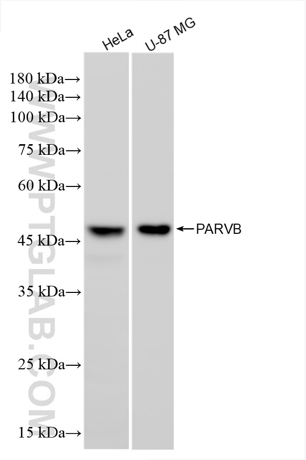 Western Blot (WB) analysis of various lysates using PARVB Recombinant antibody (85711-1-RR)