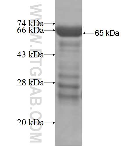 PARVB fusion protein Ag5760 SDS-PAGE