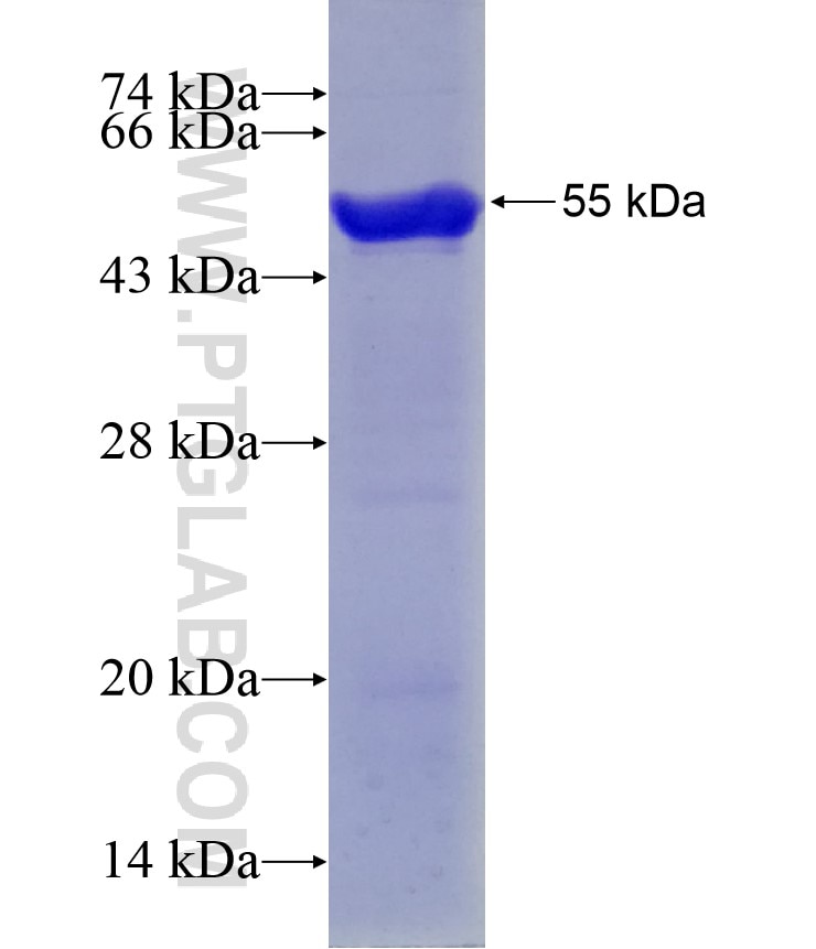 PARVB fusion protein Ag5993 SDS-PAGE