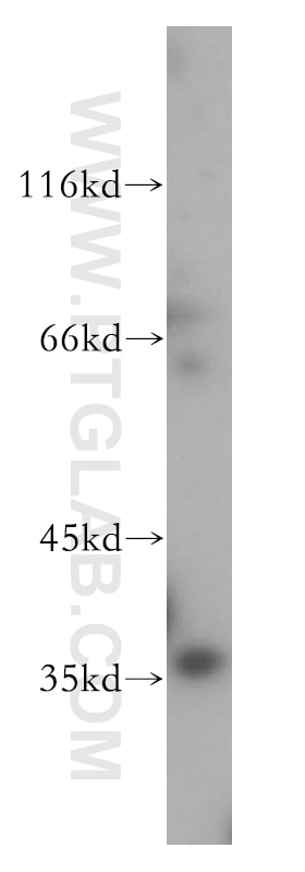 Western Blot (WB) analysis of HL-60 cells using PARVG Polyclonal antibody (13284-1-AP)