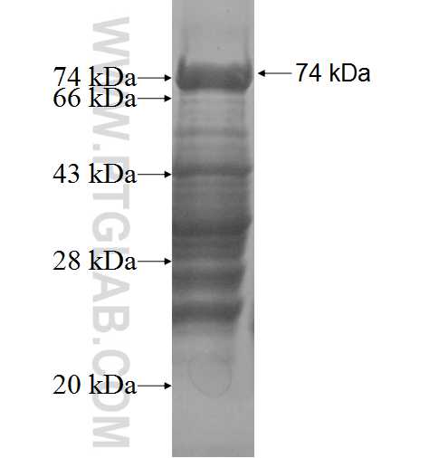 PASD1 fusion protein Ag3587 SDS-PAGE