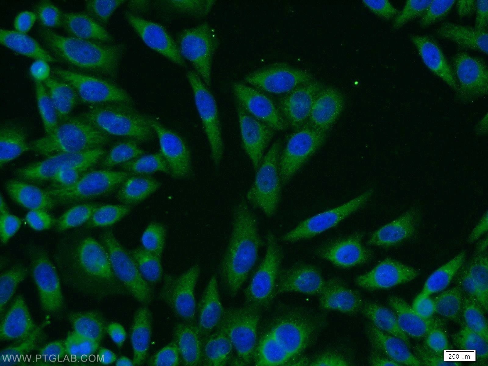 Immunofluorescence (IF) / fluorescent staining of HeLa cells using PASK Polyclonal antibody (14396-1-AP)