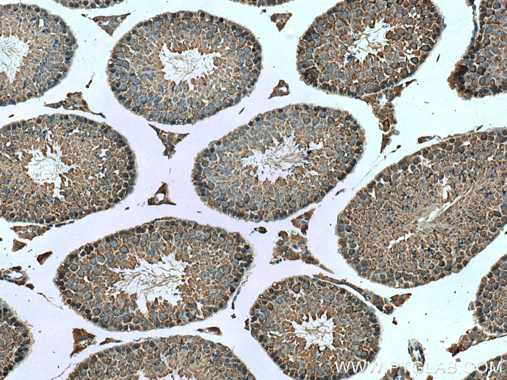 Immunohistochemistry (IHC) staining of mouse testis tissue using PASK Polyclonal antibody (14396-1-AP)