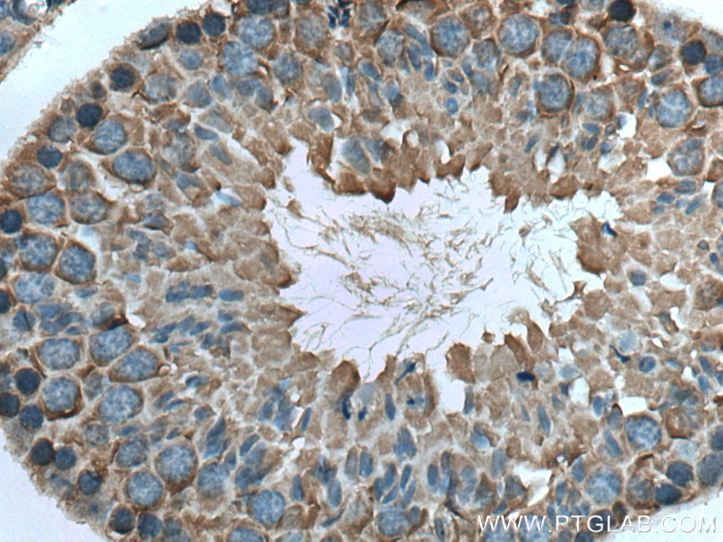 Immunohistochemistry (IHC) staining of mouse testis tissue using PASK Polyclonal antibody (14396-1-AP)