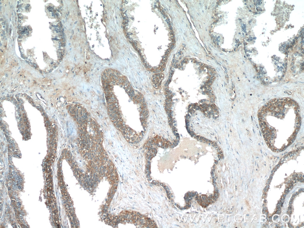 Immunohistochemistry (IHC) staining of human prostate hyperplasia tissue using PASK Polyclonal antibody (14396-1-AP)