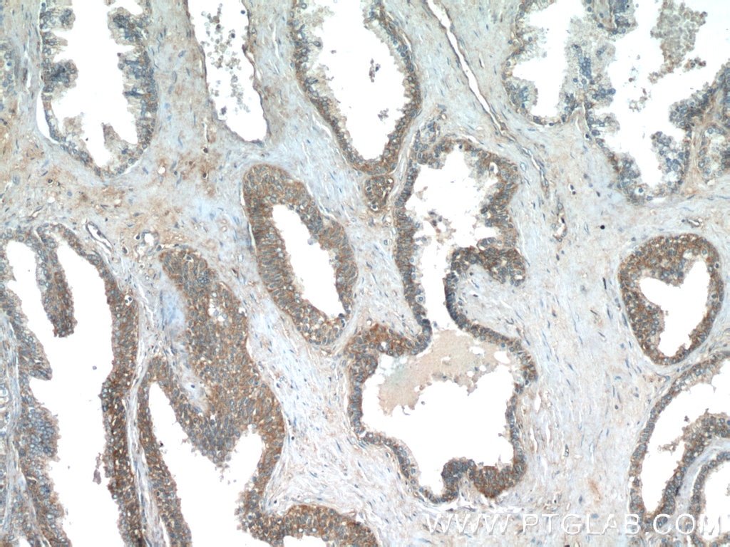 Immunohistochemistry (IHC) staining of human prostate hyperplasia tissue using PASK Polyclonal antibody (14396-1-AP)