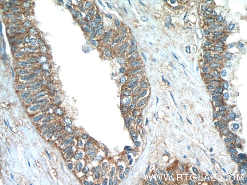 Immunohistochemistry (IHC) staining of human prostate hyperplasia tissue using PASK Polyclonal antibody (14396-1-AP)