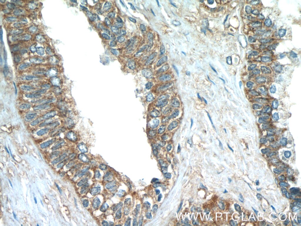 Immunohistochemistry (IHC) staining of human prostate hyperplasia tissue using PASK Polyclonal antibody (14396-1-AP)