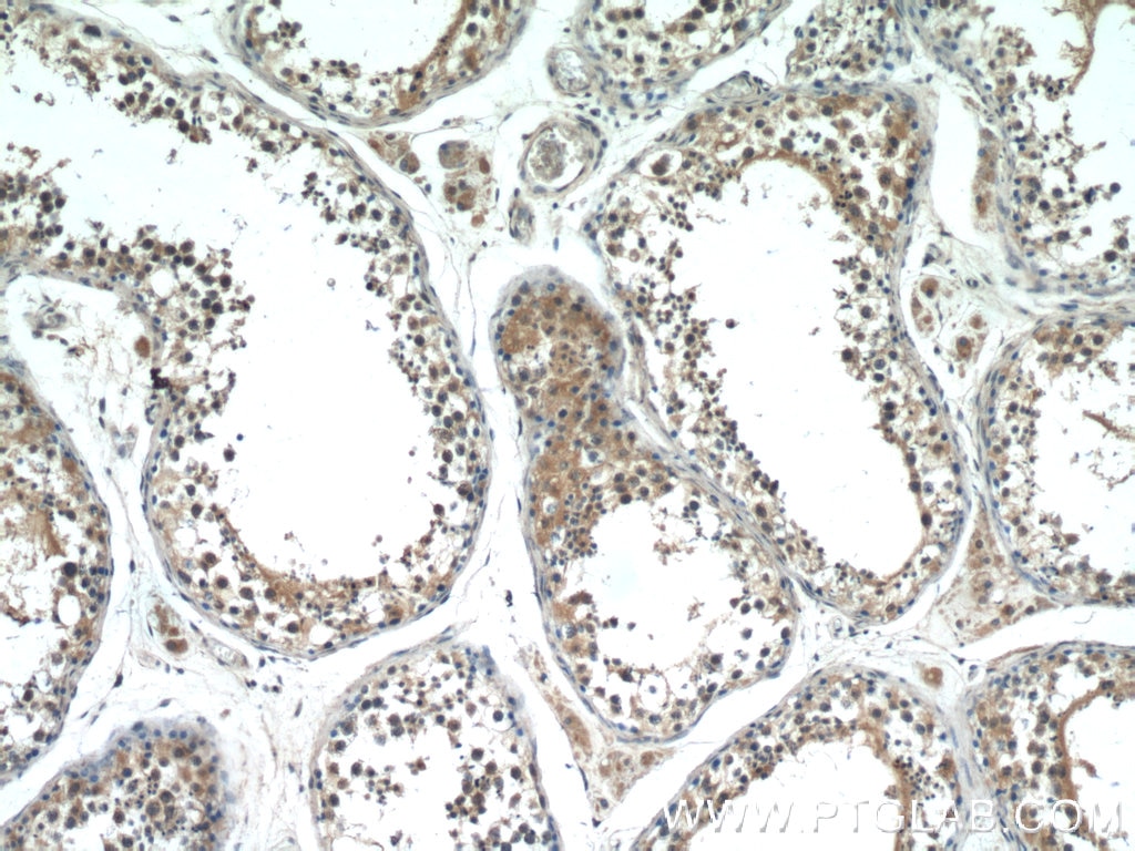 Immunohistochemistry (IHC) staining of human testis tissue using PASK Polyclonal antibody (14396-1-AP)