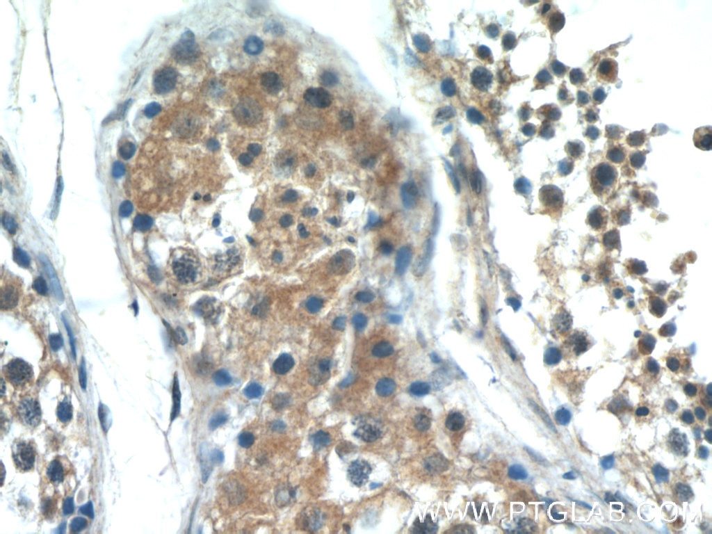 Immunohistochemistry (IHC) staining of human testis tissue using PASK Polyclonal antibody (14396-1-AP)