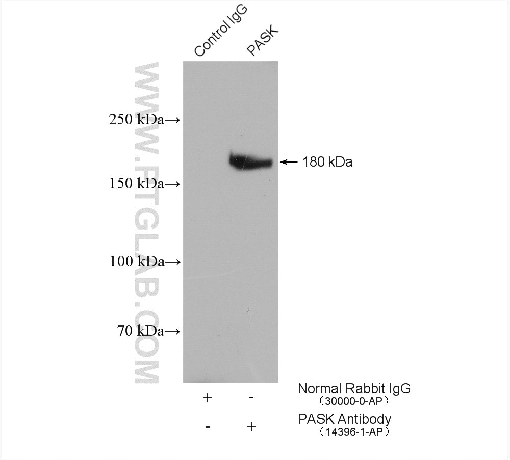 Immunoprecipitation (IP) experiment of K-562 cells using PASK Polyclonal antibody (14396-1-AP)