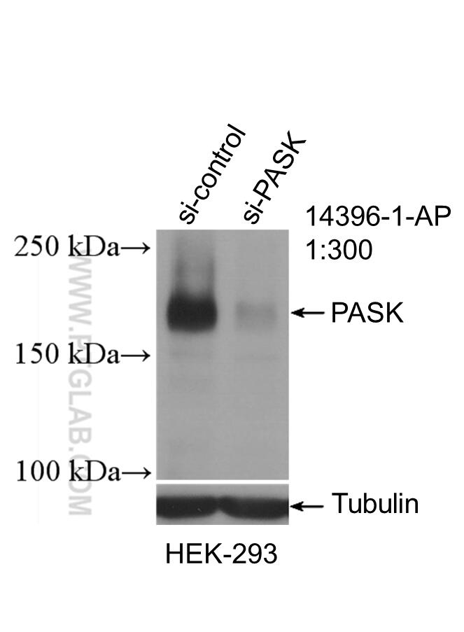 Western Blot (WB) analysis of HEK-293 cells using PASK Polyclonal antibody (14396-1-AP)