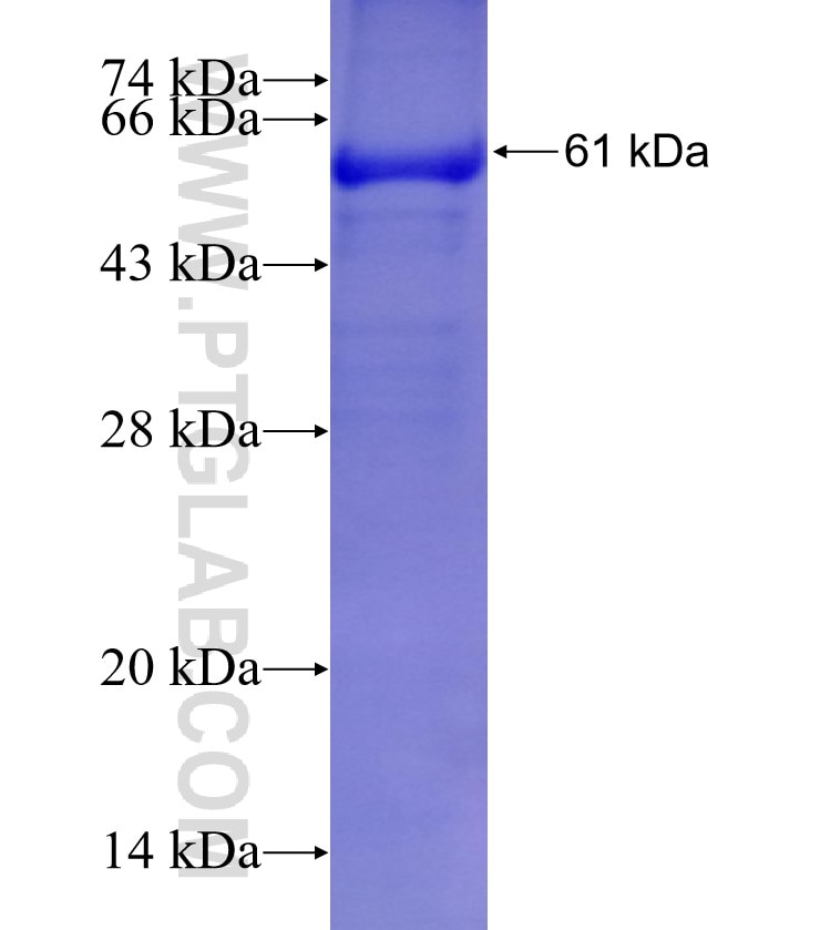 PASK fusion protein Ag5893 SDS-PAGE
