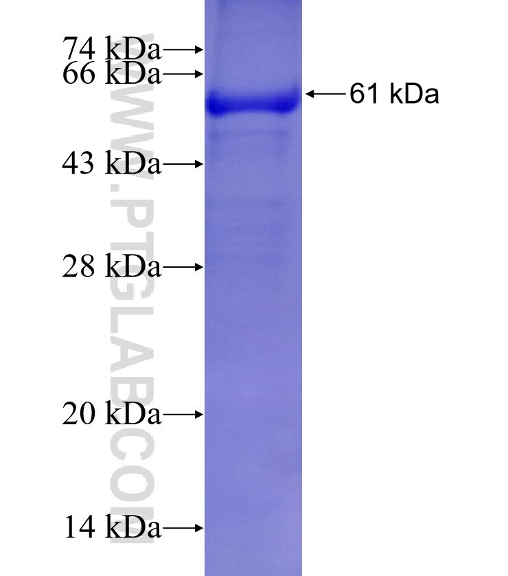 PASK fusion protein Ag5893 SDS-PAGE