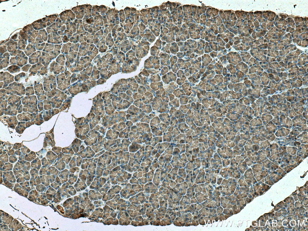 Immunohistochemistry (IHC) staining of human pancreas tissue using CPB1 Polyclonal antibody (12600-1-AP)