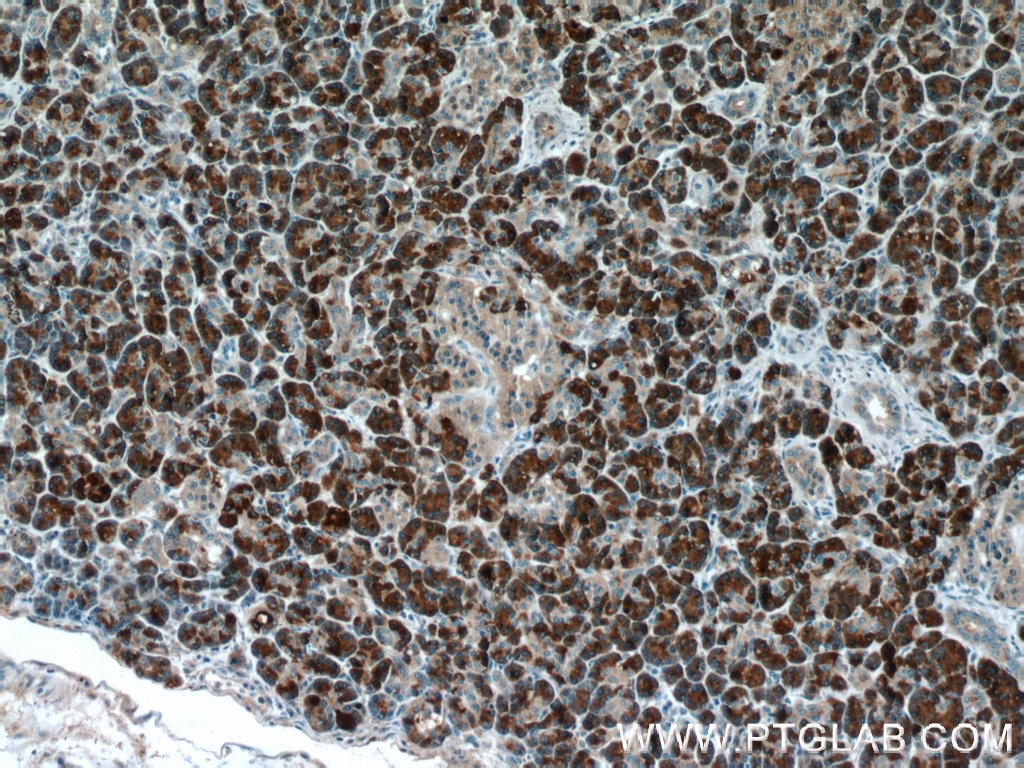 Immunohistochemistry (IHC) staining of human pancreas tissue using CPB1 Polyclonal antibody (12600-1-AP)