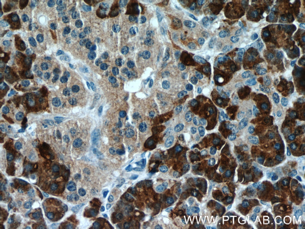 Immunohistochemistry (IHC) staining of human pancreas tissue using CPB1 Polyclonal antibody (12600-1-AP)