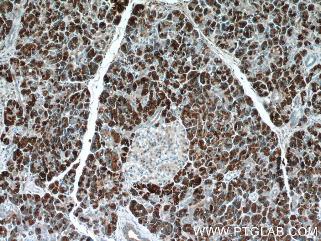 Immunohistochemistry (IHC) staining of human pancreas tissue using CPB1 Polyclonal antibody (12600-1-AP)