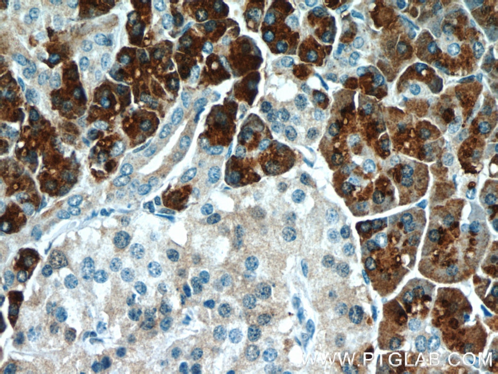 Immunohistochemistry (IHC) staining of human pancreas tissue using CPB1 Polyclonal antibody (12600-1-AP)